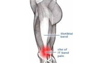 What Is Iliotibial Band Syndrome & Why Do Cyclists Experience It?