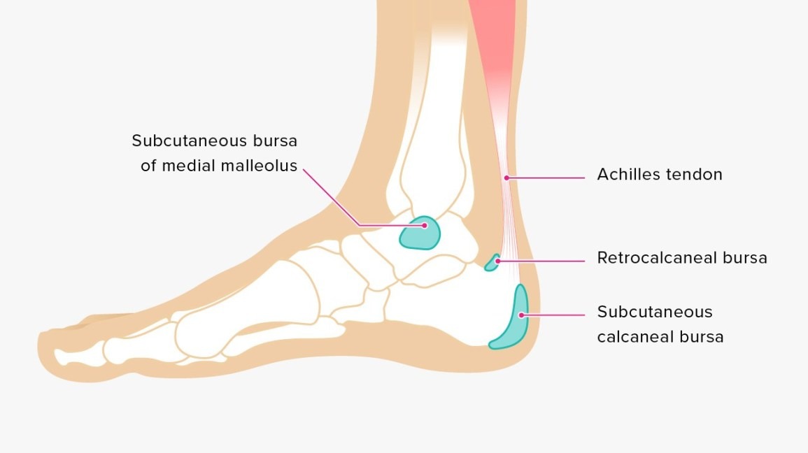 Calcaneus inflammation on sale