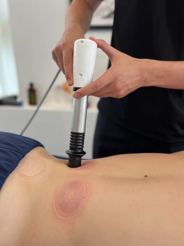 London Shockwave Therapy