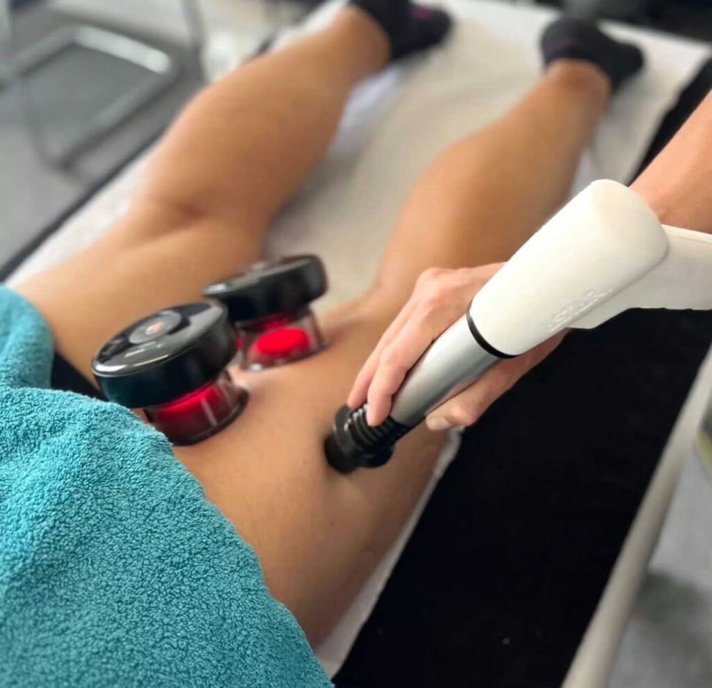 Sciatica 1 Shockwave Therapy London