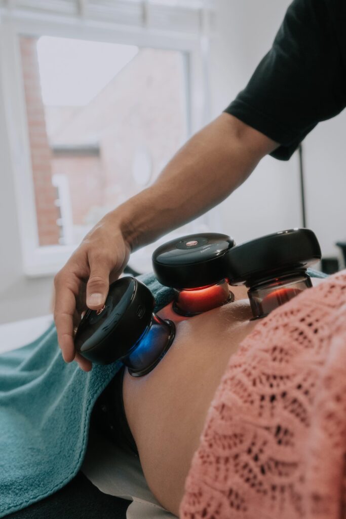 Cupping Therapy In Oxford Circus – London 1 Cupping Therapy London